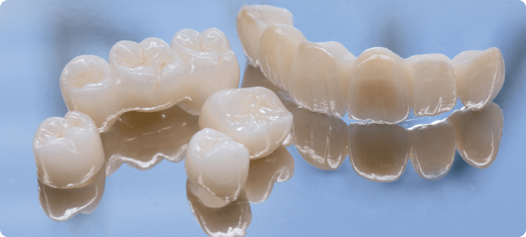 Restaurations dentaires