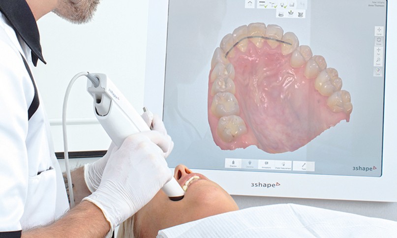 Dr Simet traitements technologies dentaires